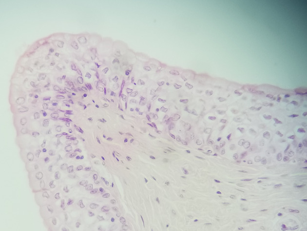 Transitional Epithelium Slides - Transitional Epithelium 07 400X